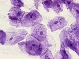 A cleavage furrow is evident and the membrane separating the two daughter cells has formed. Gce Cie Biology Animal And Plant Cell Structures Photomicrographs Biology Gce Cie Cell Structure Plant Cell Animal Cell