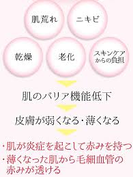 赤ら顔必見 今まで不明だった原因が判明 業界初の専用ケアのおかげで1ヶ月で赤みのないキメ美肌になれました happiness woman 赤ら顔 赤ら顔 メイク 美肌