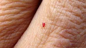 When they bite, it causes skin response in the form of itching which usually intensifies at night. How To Know When It S A Chigger Bite Everyday Health