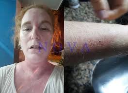 Basail tierra de nadie, beneficios para pocos