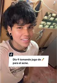 Día 4: Jugo de Zanahoria para el Acné