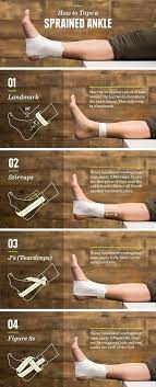 Visual Guide To Tape A Sprained Ankle Treating A Sprained Ankle Sprained Ankle Anti Aging Quotes