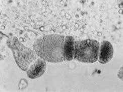 Image result for Cyperus breviradius