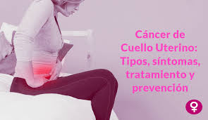 ¿qué es el cáncer de cuello de el cáncer de cuello de útero es una enfermedad seria que puede amenazar la vida. Conoce Todo Sobre Lo Que Es Cancer De Cuello Uterino