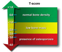 bone densitometry johns hopkins medicine