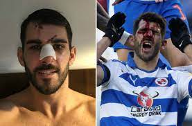 Mings #oliveira #stampsonhead tyrone mings stamps on reading's nelson oliveira's head during tyrone mings apologises after brutal stamp on reading's oliveira leaves face pouring with blood. Aston Villa News Nelson Oliveira Breaks His Silence After Tyrone Mings Horrific Stamp On Reading Star Metro News