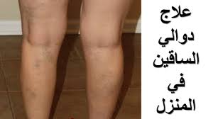 نتناول فى هذا الموضوع علاج الامساك , علاج الامساك بالاعشاب , علاج الامساك بالادوية , واهم اسباب الامساك وطرق الوقاية منه هذا بالاضافة إلى طرق علاج الامساك عند الاطفال والرضع و علاج الامساك المزمن من خلال نصائح عامة ونظام التغذية المناسب واهم الوصفات والاعشاب. Ø£ÙØ¶Ù ÙØµÙØ§Øª Ø¹ÙØ§Ø¬ Ø¯ÙØ§ÙÙ Ø§ÙØ³Ø§ÙÙÙ Ø·Ø±Ù Ø¹ÙØ§Ø¬ Ø¯ÙØ§ÙÙ Ø§ÙØ³Ø§ÙÙÙ Ø¨Ø§ÙØ£Ø¹Ø´Ø§Ø¨ ÙÙ Ø§ÙÙÙØ²Ù Youtube