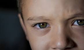 Cocukluk Cagi Goz Tumorleri Ve Retinoblastoma Cocukludunya