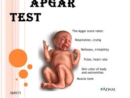 Apgar Score