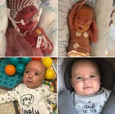 Giveblood On Twitter Blood Transfusions Saved My Baby S Life Mason Was Born At 26 Weeks And Is Now 6 And A Half Months Old He Received 9 Blood Transfusions During His