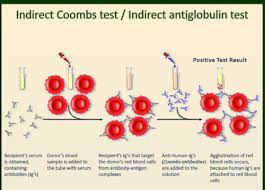 Image result for Indirect Coombs