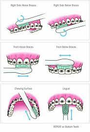 Why you should brush your gums. How To Brush Your Teeth With Starlight Dental Clinic Facebook