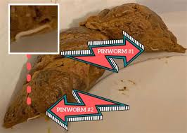 Image result for Pinworm