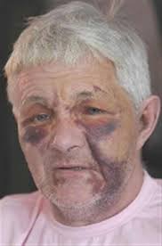 Chef 'traumatised' after pub attack