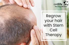 She is also author of the thyroid guide to hair loss. Regrow Your Hair With Stem Cell Therapy Cordlife India Blog