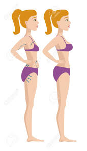Here's a study that will make you blush. Plastic Surgery Body Parts Woman Correction Anaplasty Medicine Royalty Free Cliparts Vectors And Stock Illustration Image 86921480
