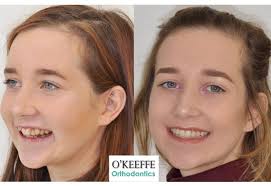 O'Keeffe Orthodontics