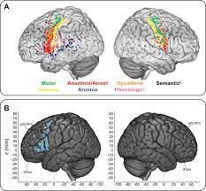 Specific groups of them, working in concert, provide us with the capacity. Revisiting The Functional Anatomy Of The Human Brain Toward A Meta Networking Theory Of Cerebral Functions Physiological Reviews