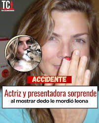 ACCIDENTE La actriz y presentadora Montserrat Oliver exhibió dos  fotografías perturbadoras; la primera de ellas evidenciando que uno de sus  dedos habría sido mutilado parcialmente y la segunda besando al hijo del