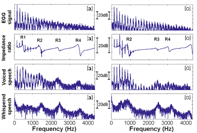 Acoustic frequency analysis reveals subtle physiological and vocal shifts, AI generated
