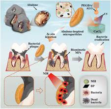 Polymeric biomaterials for periodontal tissue engineering and periodontitis  - RSC Applied Polymers (RSC Publishing) DOI:10.1039D4LP00001C
