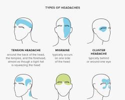 Image of Headache