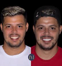 Luiz Marotti (@drluizmarotti) · Instagram 照片和视频