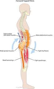 Pin On Corrective Care