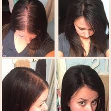 New featuresexperiences bonus gifts the wedding book group gifting. I M A 16 Year Old Girl And My Baby Hair Is Falling Out And My Hairline Is Receding What Can I Do To Stop This Help Them Grow Back Quora