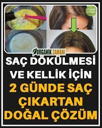 Sac Dokulmesi Ve Kellik Icin 2 Gunde Sac Cikartan Dogal Cozum Hair Loss Growth Long Hair Styles Beauty Tips For Hair