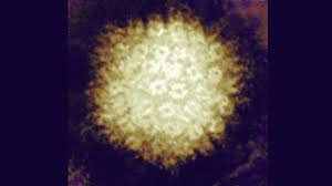 For females, you need to keep the virginal area dry and avid irritating chemicals. Genital Ulcer Sores In Female