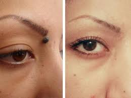 Принцип «око за око» сделает весь мир слепым. ÙÙŠ Ø­Ù…Ø© Ø§Ù„Ø¹ÙŠÙ† Ø§Ù„ØµÙˆØ±Ø© ÙˆØ§Ù„Ø¥Ø²Ø§Ù„Ø©