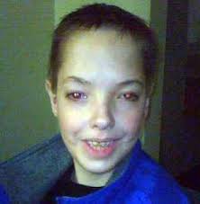 Casey Allen Luffman (1990-2009)