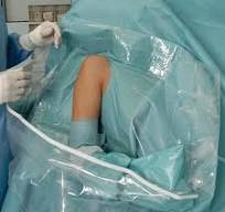 Foliodrape® Protect Shoulder Arthroscopy Set