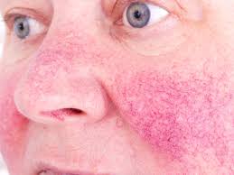 These bumps may be milia, which are caused by dead skin cells becoming trapped under the surface of the skin. Skin Bumps That Look Like Pimples But Aren T Insider