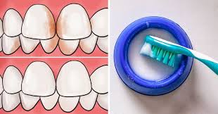 Make sure to make flossing part of your daily routine. 10 Ways To Remove Tartar Stains From Your Teeth
