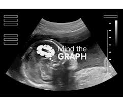 Image result for Biophysical Profile