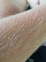 Leg hair can also decrease in circumference, resulting in thinner, softer leg hair. Im A True Blond So My Arm And Leg Hair Is White Age 21 Leg Hair Blonde Hair