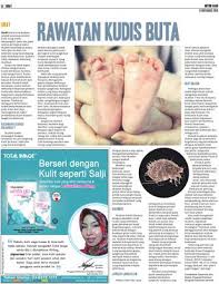 Kudis buta pada orang dewasa. Rawatan Kudis Buta Klik