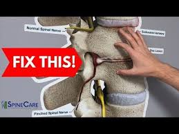 Pin On Back Pain