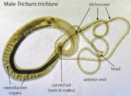Check spelling or type a new query. Whipworm In Humans Symptoms Prevention Diagnosis Whipworm Treatment