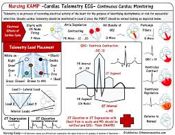 Ecg Telemetry Monitoring Cardiac Nursing Critical Care
