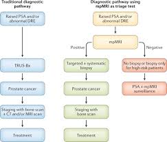 The american cancer society estimates that over 21,000 people in the united states will be diagnosed with ova. Multiparametric Mri For Prostate Cancer Diagnosis Current Status And Future Directions Nature Reviews Urology