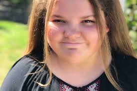 Fundraiser by Julie Williamson : Help Macey Get Surgery