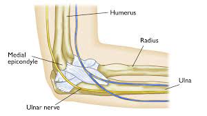 This can be the result of strain caused by repetitive movements with your arm or hand, previous elbow injury or associated with other medical conditions. Ulnar Nerve Entrapment At The Elbow Cubital Tunnel Syndrome Orthoinfo Aaos