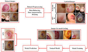 Image result for IDSA Diabetic Foot Wound Classification