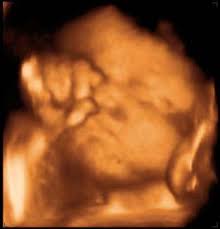 Pin On About Pregnancy