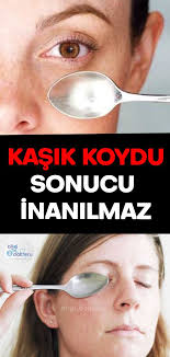 Gozalti Siskinligine Ve Morluklara Karsi 3 Pratik Yontem Homemade Skin Care Skin Care Skin