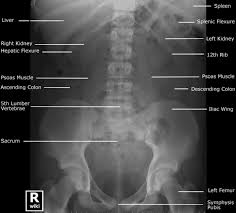 Pin By Lauren Cachera On Radiology Medical Radiography Radiology Humor Radiology Imaging