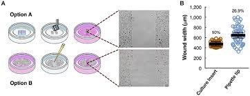Mitosis and meiosis are two kinds of cell division that are essential to most forms of life on earth. Frontiers In Vitro Cell Migration Invasion And Adhesion Assays From Cell Imaging To Data Analysis Cell And Developmental Biology
